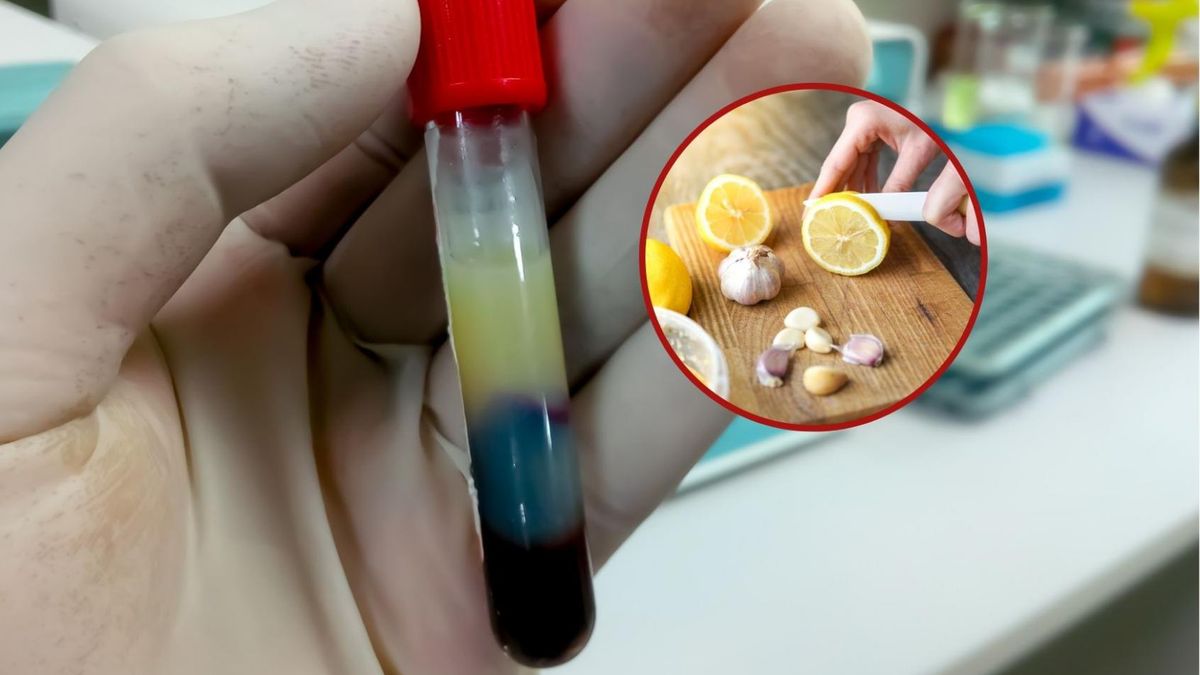 Prosta mikstura, która oczyści tętnice ze złogów