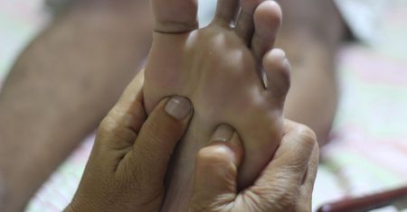 Przyjrzyj się stopom. Możesz zauważyć na nich objawy cukrzycy, miażdżycy