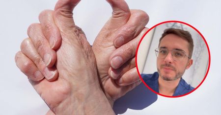 Potrafisz zrobić tak z kciukiem? Jak najszybciej skontaktuj się z lekarzem