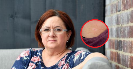 Pozornie niewinne? U 44-latki to był objaw groźnego nowotworu