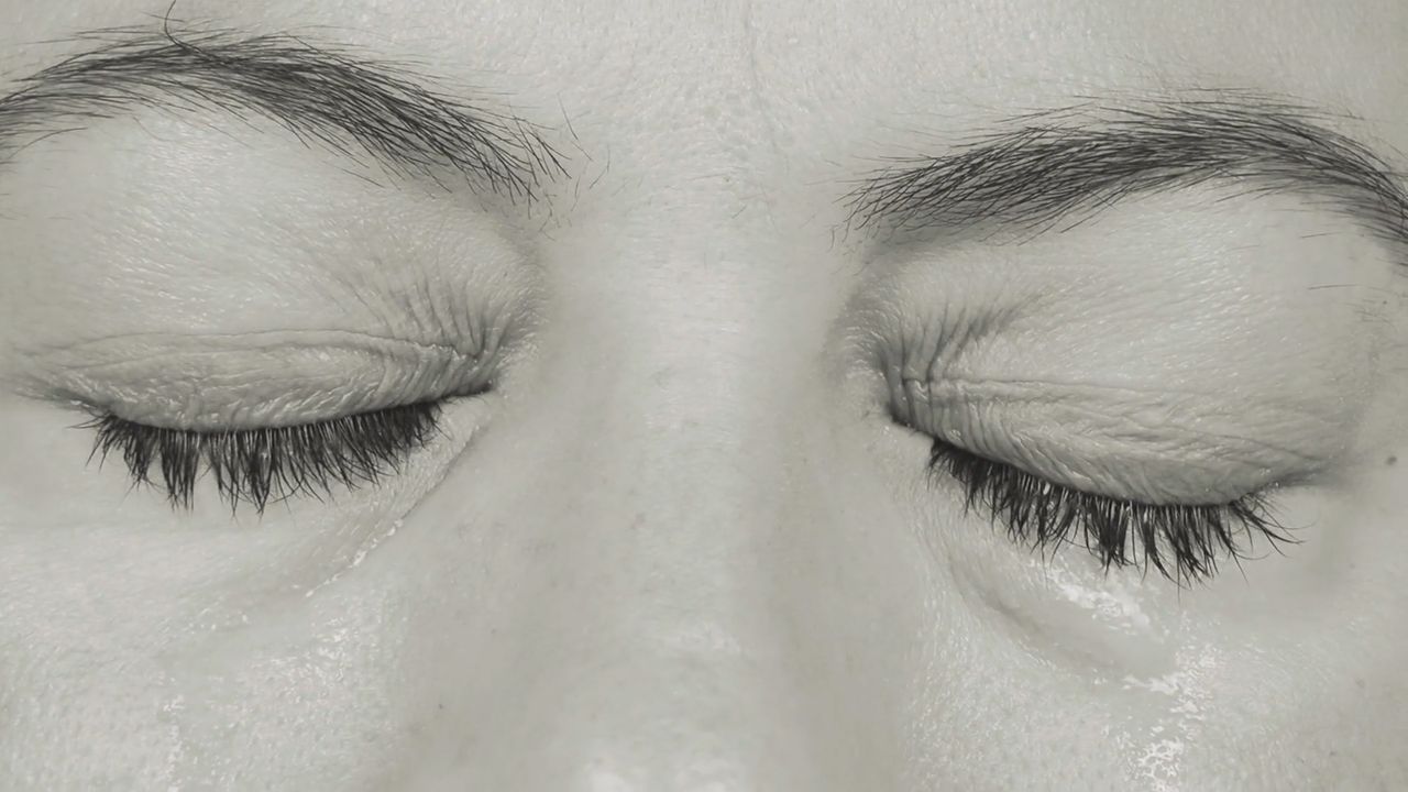 Czerniak to nie tylko rak skóry. 59-latka miała czerniaka oka (WIDEO)