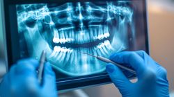 Zmiany u dentysty. 1 czerwca weszło w życie zarządzenie NFZ