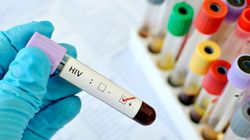 Największe mity na temat HIV - obalają eksperci