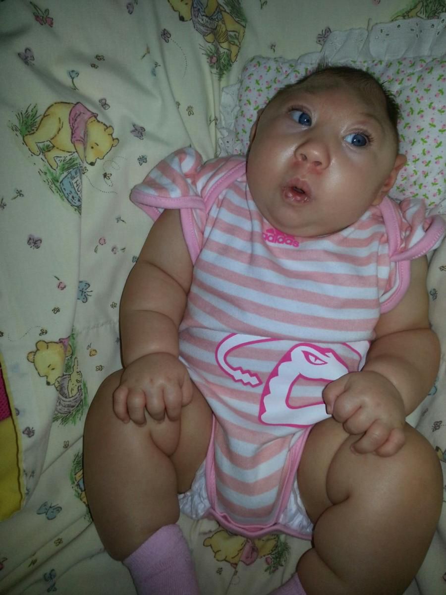 Cierpi na śmiertelną wadę wrodzoną