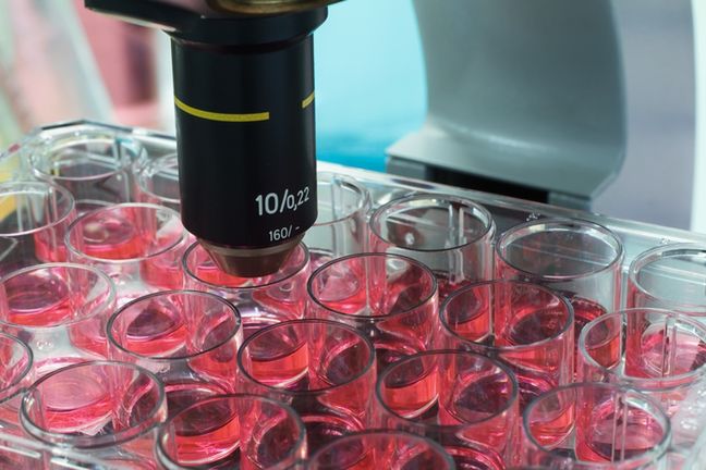 Cytologię wykonywac możemy na kilka sposobów, a wyniki cytologii dadzą nam ważne informacje
