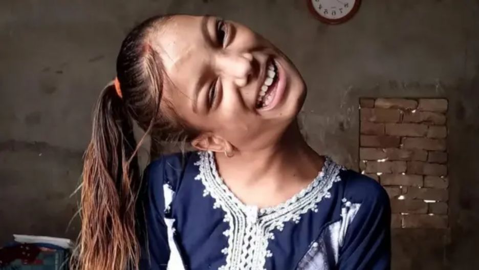 Jej szyja była wygięta pod kątem 90 stopni. Lekarze dokonali cudu