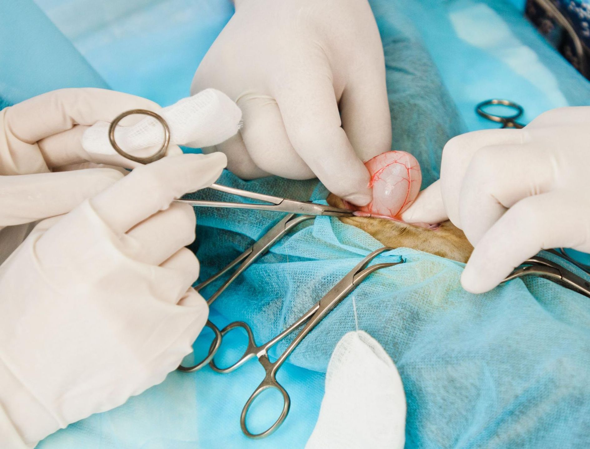 Nietrzymanie moczu można wyleczyć operacyjnie