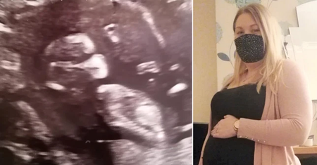 Młoda mama nie mogła powstrzymać się od śmiechu podczas badania USG. Dziecko wyglądało jakby miało na sobie maseczkę