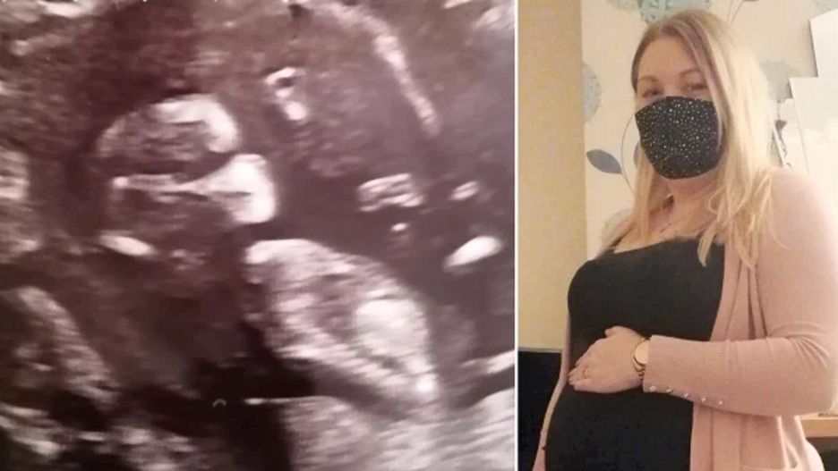 Zdjęcie USG rozbawiło młodą mamę