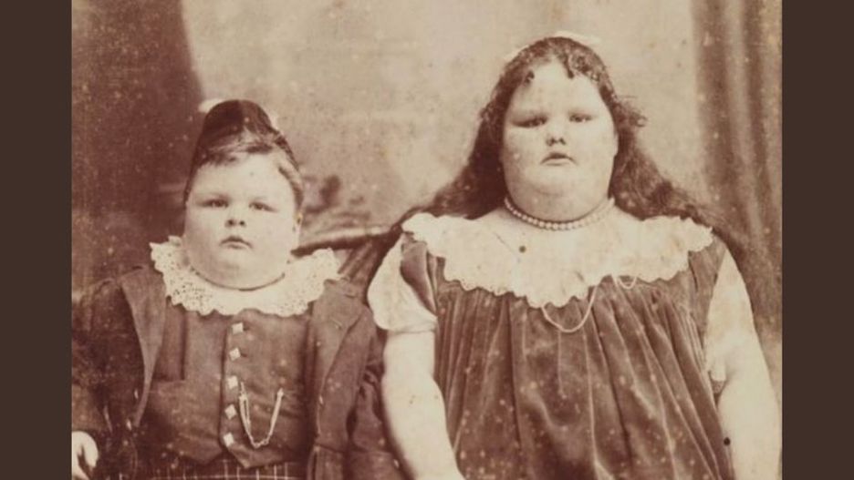 Traktowano je jak sensację. Rodzice oddali dzieci do cyrku