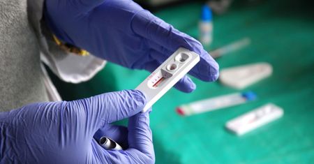 Największe mity na temat HIV - obalają eksperci
