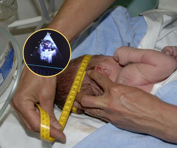 Przyczyna wzdętego brzuszka niemowlęcia wstrząsnęła lekarzami. Rozwinął się tam pasożytniczy płód