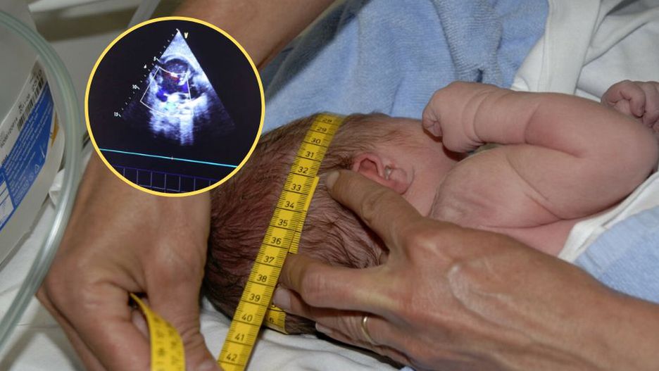 Przyczyna wzdętego brzuszka niemowlęcia wstrząsnęła lekarzami. Rozwinął się tam pasożytniczy płód