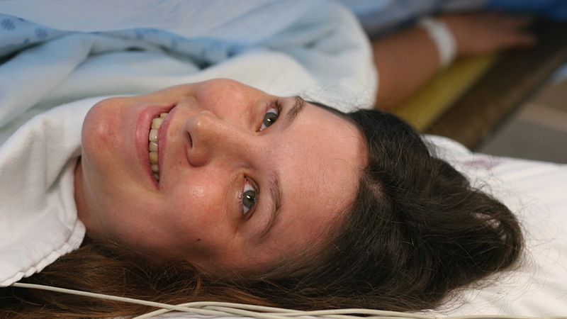 Cesarskie cięcie film  - przebieg, znieczulenie, rana