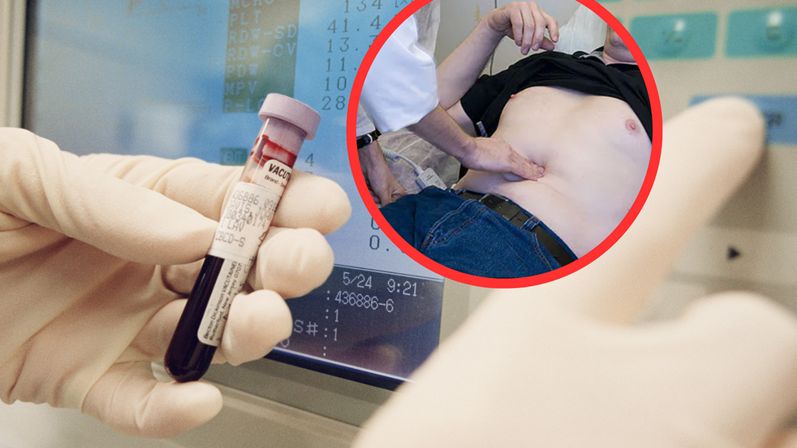 Nowy test na raka trzustki
