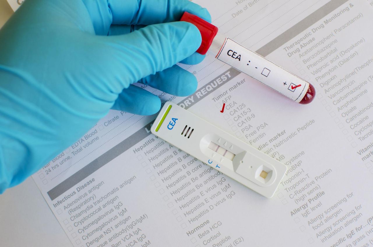 Niepozorne dolegliwości, które mogą być objawem nowotworu