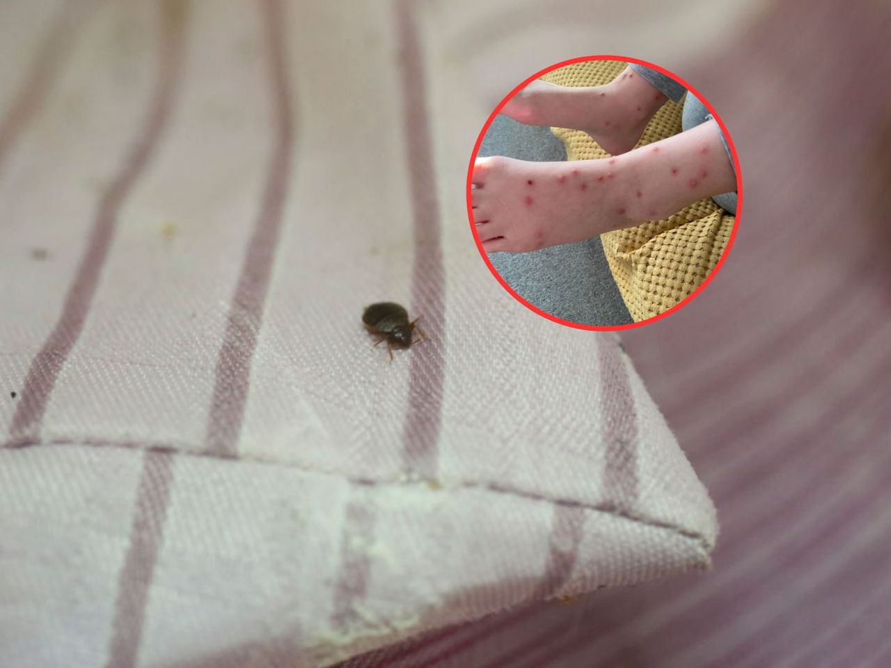 Dziecko obudziło się pogryzione. Przeraziła się, gdy sprawdziła łóżko