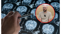 Zapomniał, że już oglądał ten film. Diagnozę usłyszał, gdy miał 41 lat