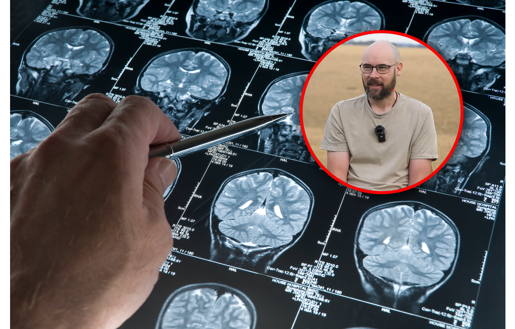 Diagnozę usłyszał, gdy miał 41 lat. Opowiedział o wczesnych objawach alzheimera