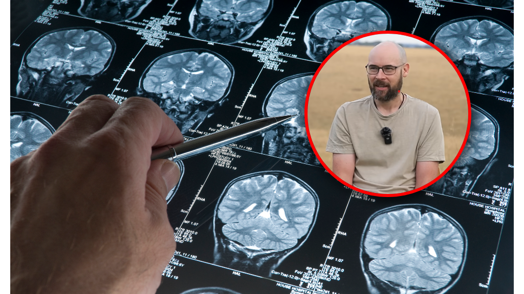 Diagnozę usłyszał, gdy miał 41 lat. Opowiedział o wczesnych objawach alzheimera