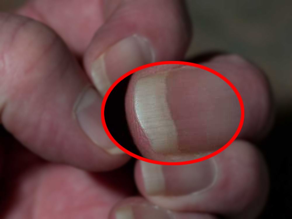 Paznokcie a zdrowie. Nie lekceważ tych zmian