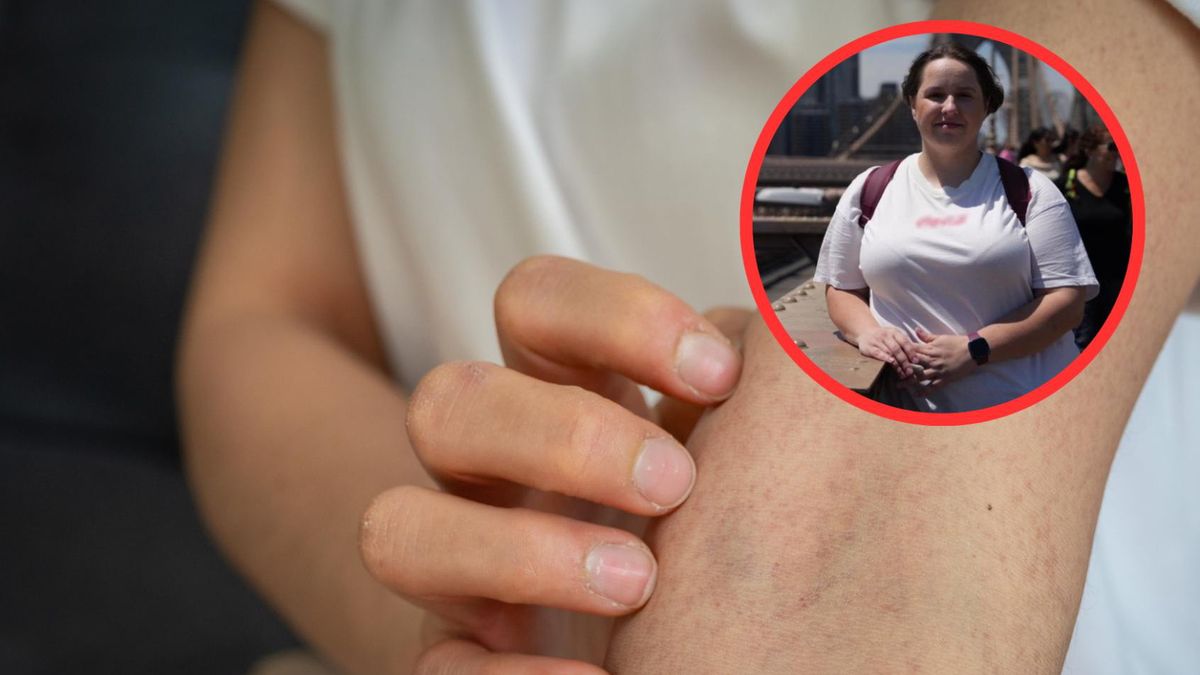 Nowotwór trzustki coraz częściej diagnozowany jest u młodych pacjentów