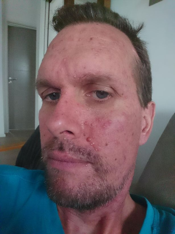 Geoffrey powiedział, że chemioterapia zmieniła jego twarz