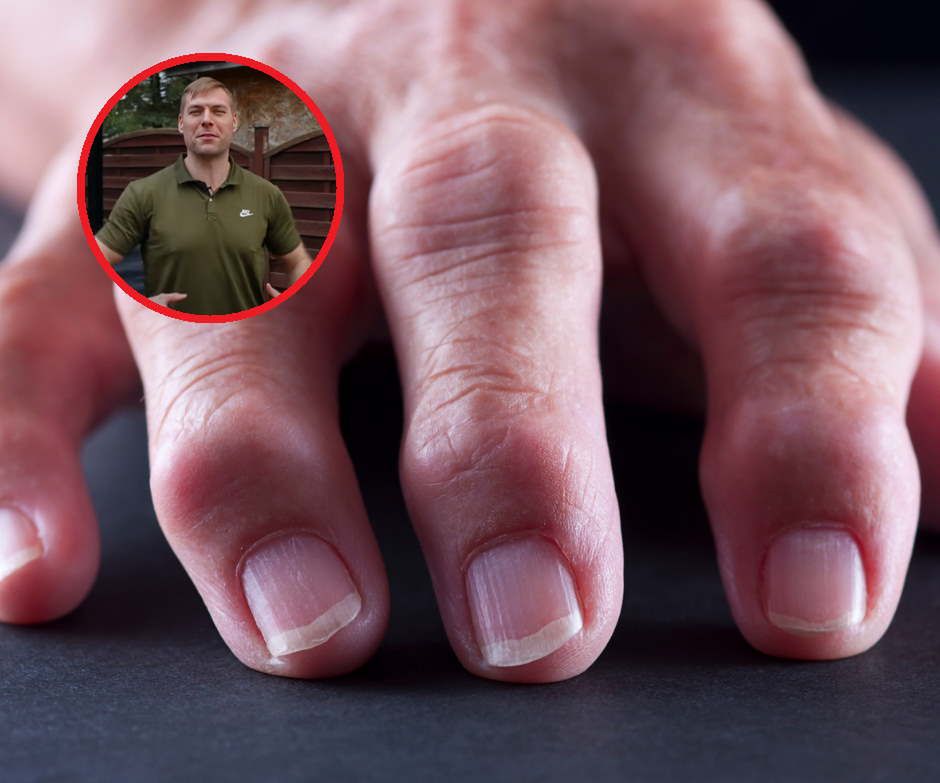 "Odrdzewiacz do stawów". Fizjoterapeuta wskazuje, jak pozbyć się bólu