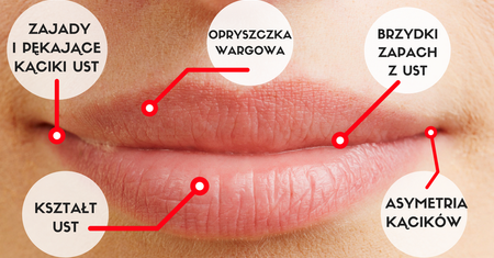 Usta wszystko Ci powiedzą