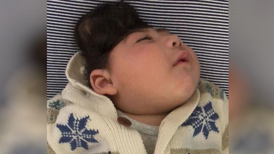 Bezczaszkowie zostało potwierdzone już podczas pierwszego badania