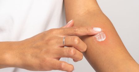 Dermilen – opinie, skład, wskazania i działanie