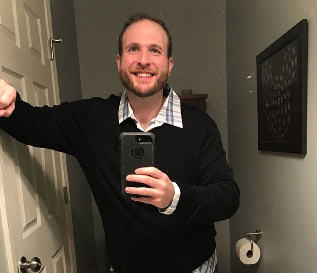 Tak Kenny Dunn wyglądał po roku terapii.