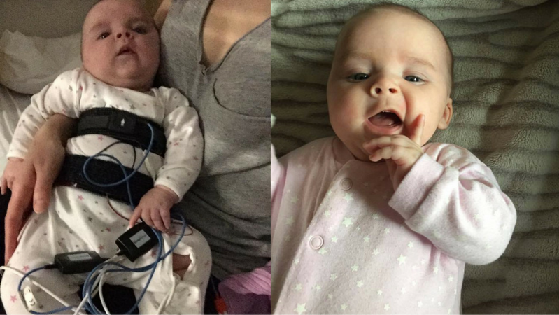 Julka walczy z rdzeniowym zanikiem mięśni