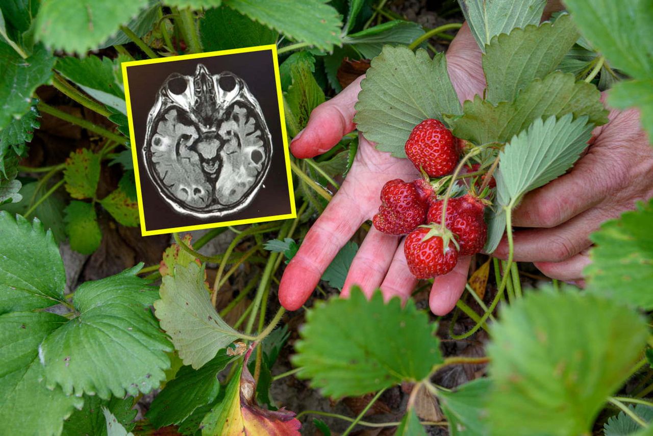 Lekarz pokazał zdjęcie mózgu. Ostrzega przed chorobą "niemytych jagód"