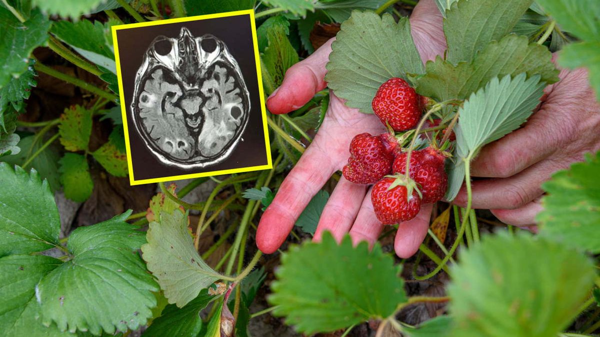 Choroba "niemytych jagód" może prowadzić nawet do zgonu pacjenta