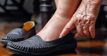 Dlaczego kostki puchną? To może być groźny objaw #ZdrowaPolka