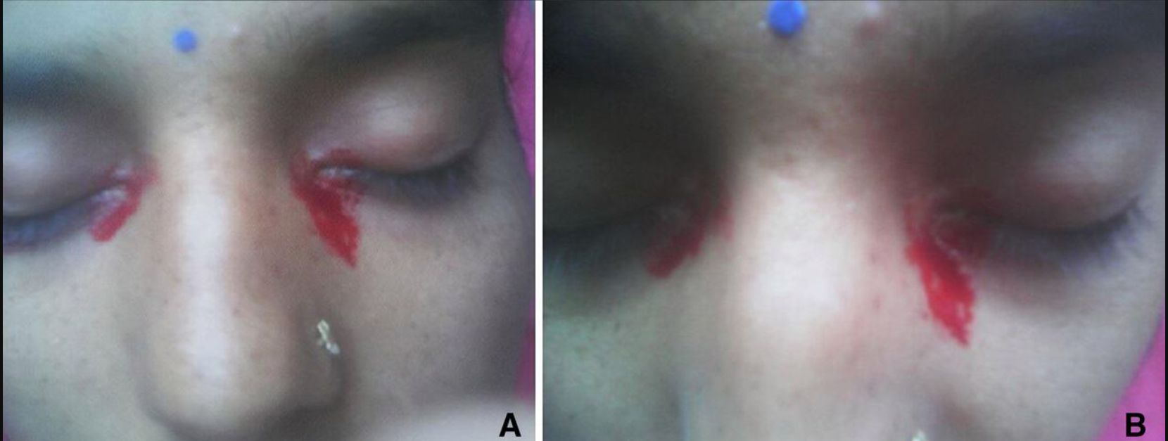 Kobieta płakała krwią