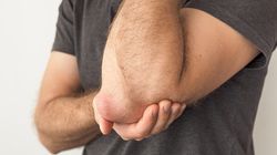 Zapalenie kaletki łokciowej - przyczyny, objawy i leczenie