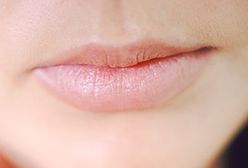 Seksualne ekscesy podczas delegacji. Czy to już norma?