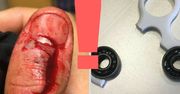 Niebezpieczny fidget spinner. Potrafi złamać kości i zerwać ścięgna