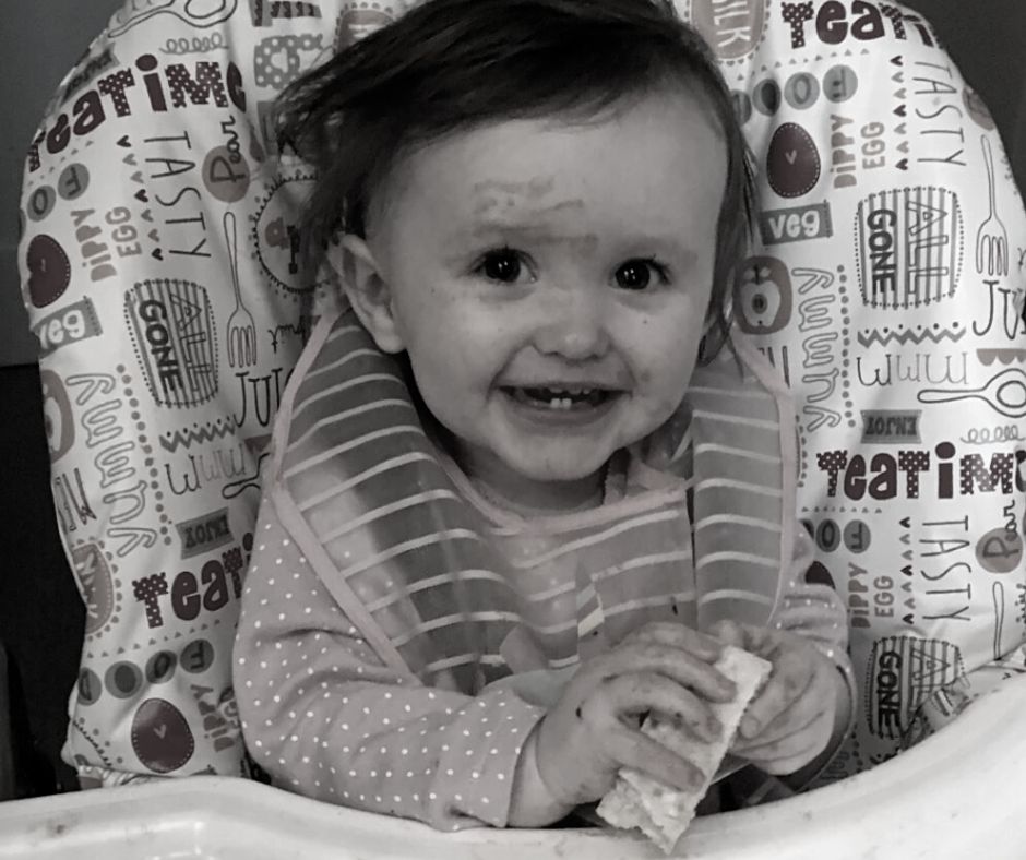 Rodzice nie wiedzieli, że dziewczynka cierpi na malformację tętniczo-żylną