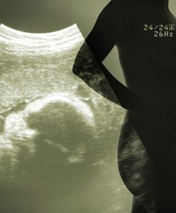 Apel o ochronę życia