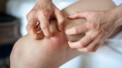 Znak, że w jelitach doszło do erozji. Toksyny mogą "wyciekać" do krwi