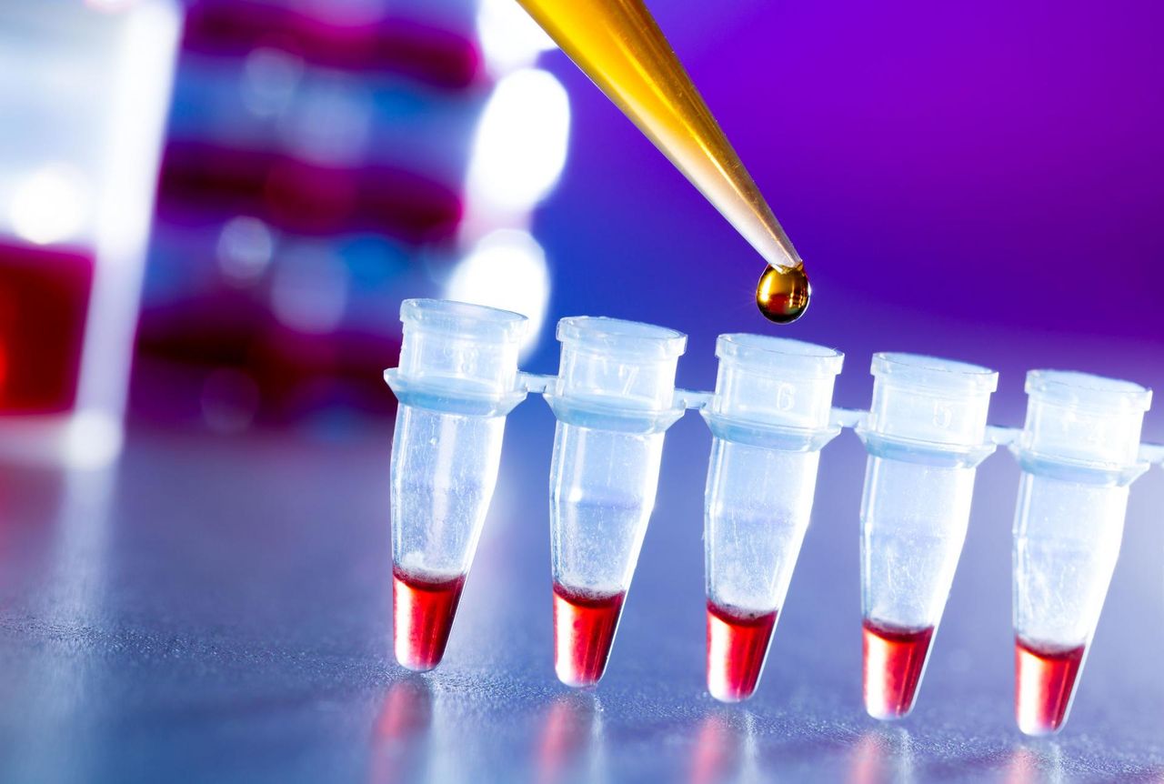 Dlaczego ciężarne nie wykonują badania na obecność wirusa HIV?