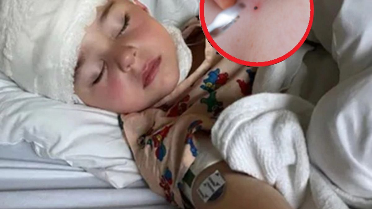 3-latek bawił się w basenie. Nagle jego mama zobaczyła czarną kropkę