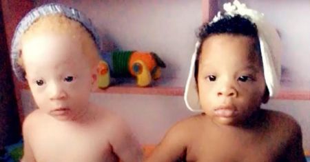 Bliźniaki o różnym kolorze skóry. Niezwykle zjawisko w Nigerii
