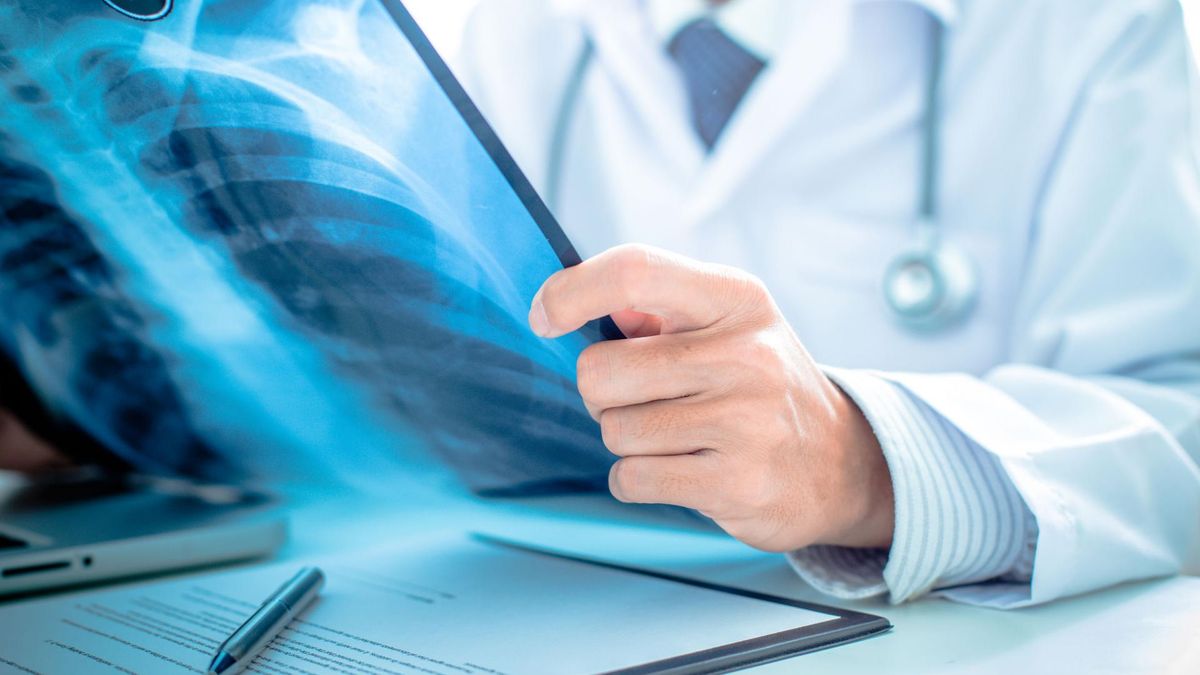 Dysplazja oskrzelowo-płucna