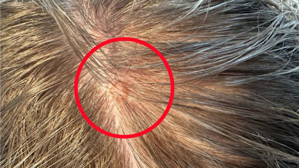 Uważaj, mogą świadczyć o groźnym nowotworze