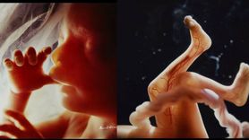 Niezwykłe zdjęcia embrionu - etapy rozwoju człowieka