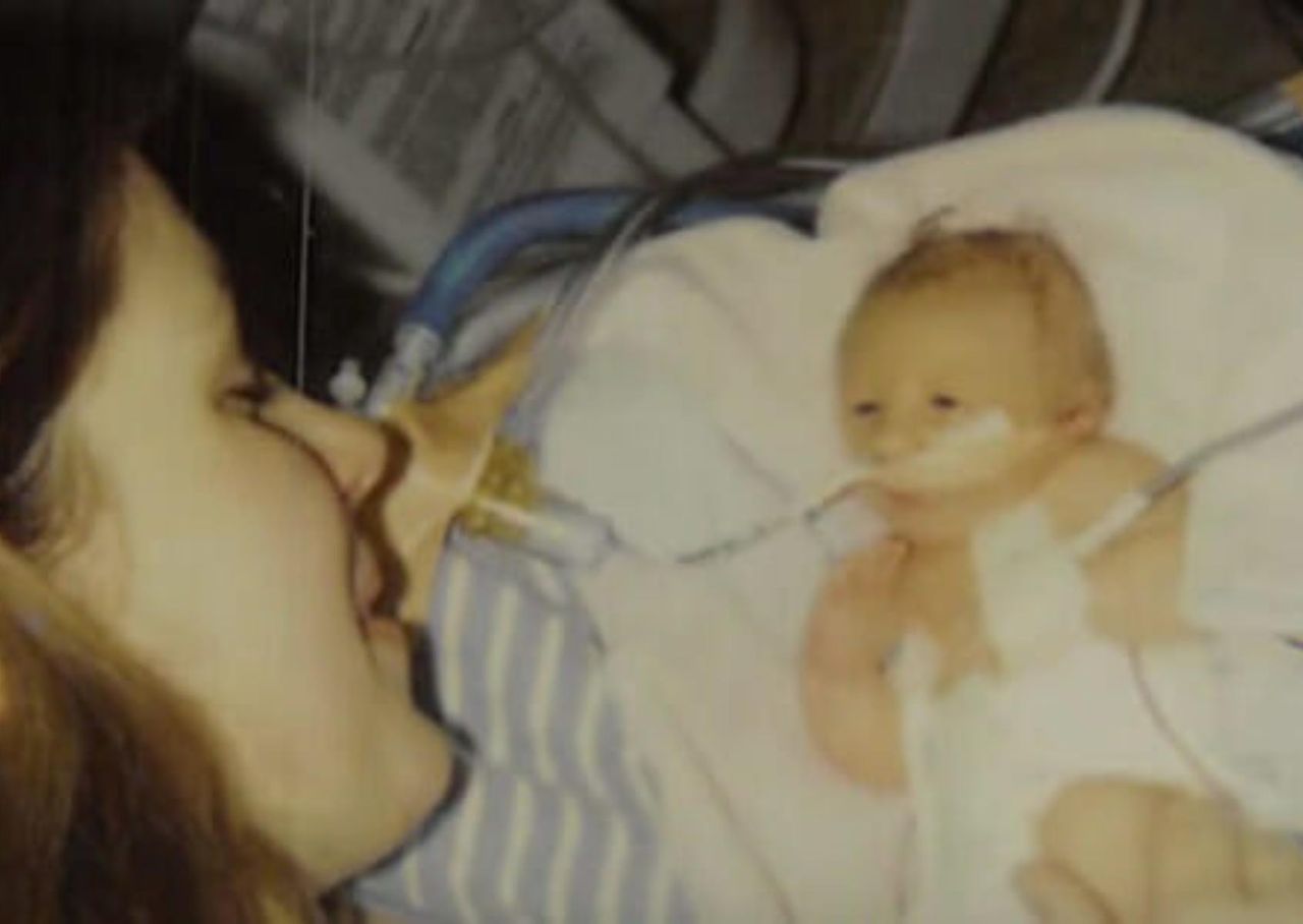 Lekarze nie dawali jej szans na przeżycie. Tak "Calineczka" wygląda 20 lat później